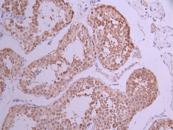 CSE1L Antibody