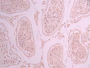 KIFC1 Antibody