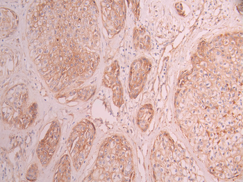 CAV2 Antibody