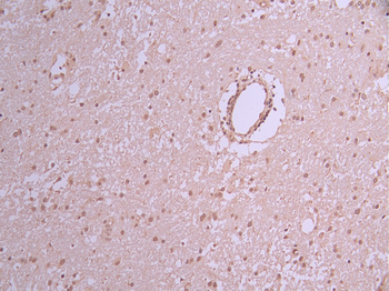 MATR3 Antibody