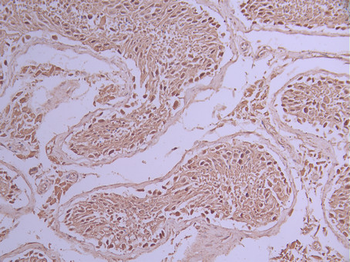 MATR3 Antibody
