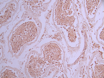 SMAD3 Antibody