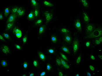 SMAD3 Antibody