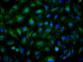 MAPRE3 Antibody