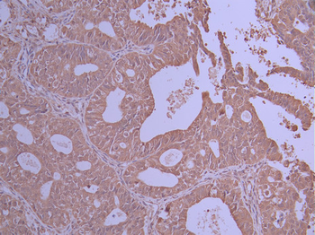 VPS35 Antibody