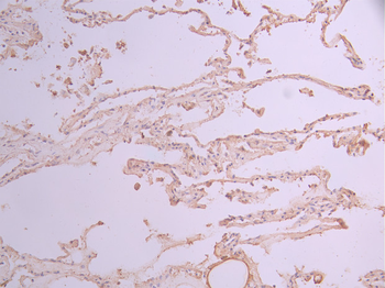 VPS35 Antibody