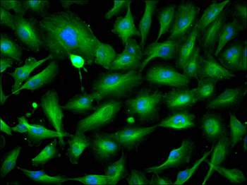 VPS35 Antibody