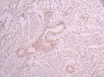 CTNND1 Antibody