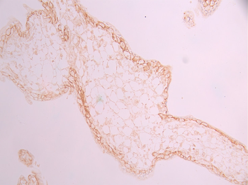 CTNND1 Antibody