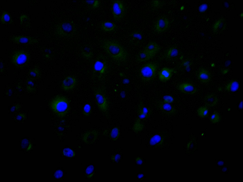 CTNND1 Antibody