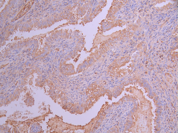 IGFBP7 Antibody