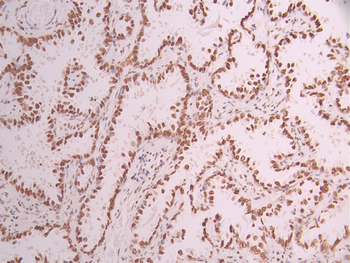 DHX9 Antibody