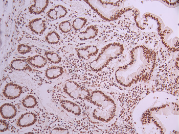 DHX9 Antibody