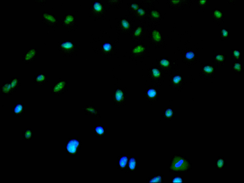 DHX9 Antibody