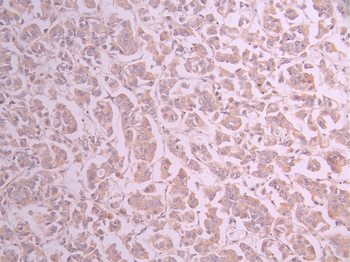 USP9X Antibody