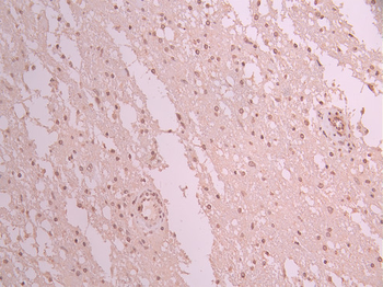 SYNE1 Antibody