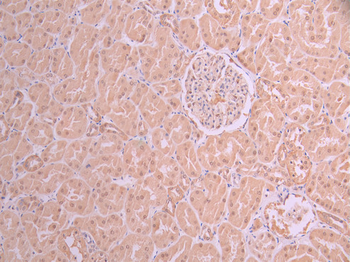 UBA1 Antibody
