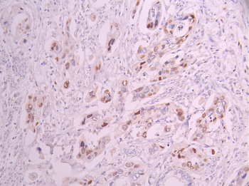 CDKN1A Antibody