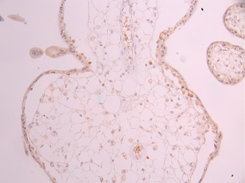CDKN1A Antibody