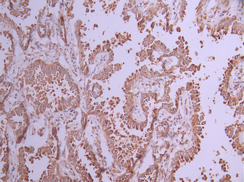POR Antibody