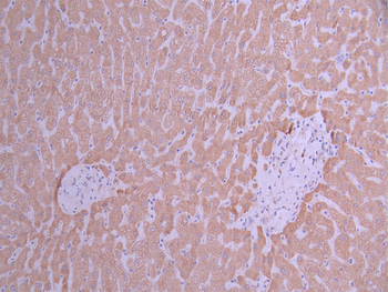 POR Antibody