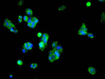 POR Antibody