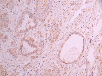 SNTA1 Antibody