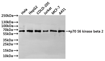 RPS6KB2 Antibody