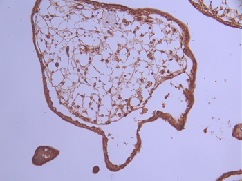 RPS6KB2 Antibody