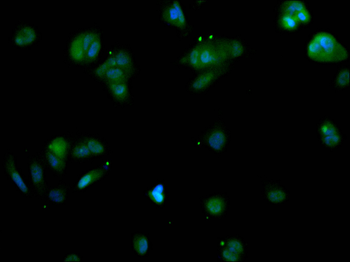RPS6KB2 Antibody