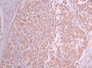 TXN2 Antibody