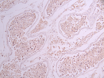 PRPF8 Antibody