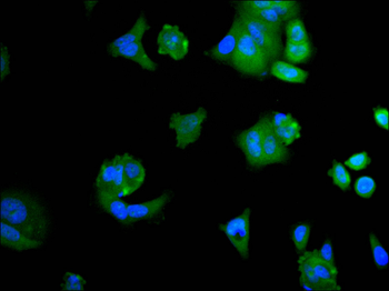 PPP1CB&PPP1CA Antibody