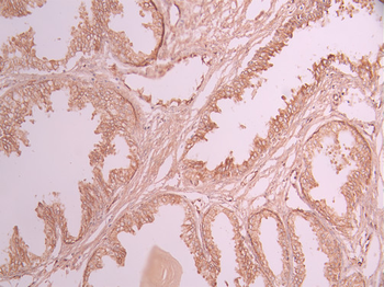 TGFA Antibody
