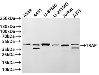 ACP5 Antibody