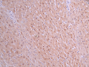 SULT2A1 Antibody