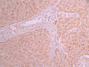 SULT2A1 Antibody