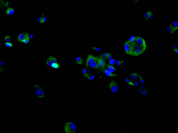 SULT2A1 Antibody