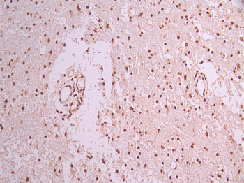 SF3B3 Antibody