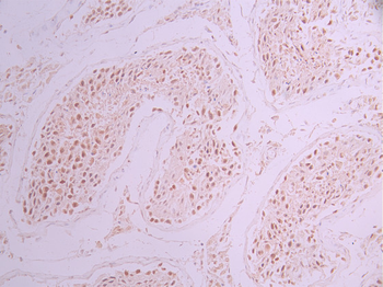 SF3B3 Antibody
