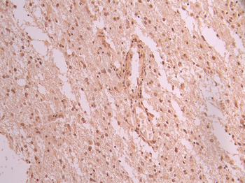 PIAS1 Antibody