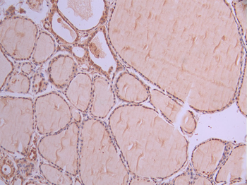PIAS1 Antibody