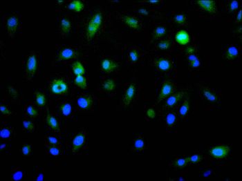 PIAS1 Antibody