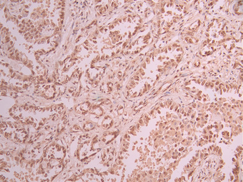 TRIM28 Antibody