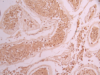 TRIM28 Antibody
