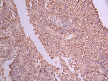 NME1 Antibody