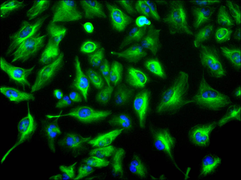 S100B Antibody