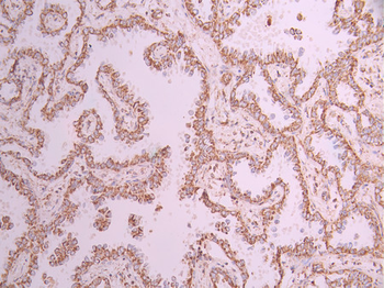 HSPE1 Antibody