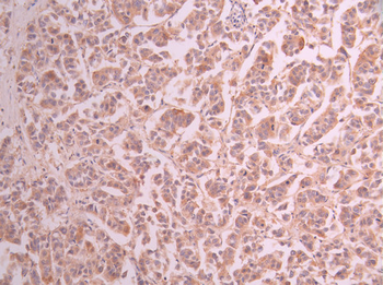 IKBKE Antibody