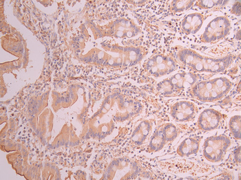 IKBKE Antibody